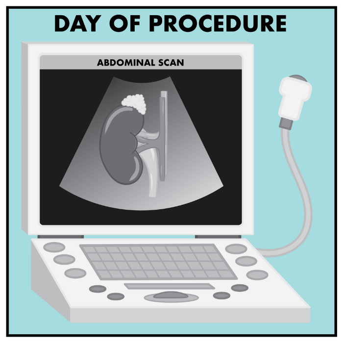 abdominal scan image