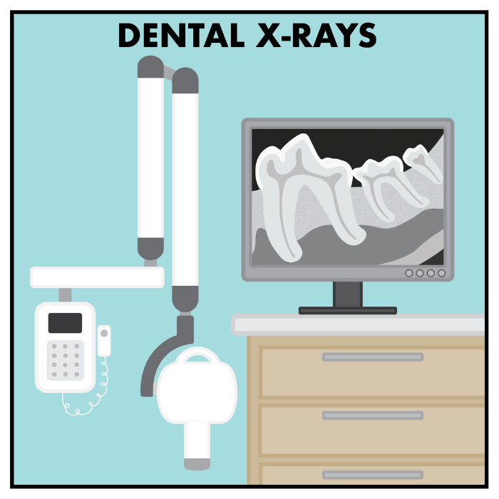 dental x ray image